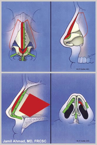 THE FACE: Tipping Points - Plastic Surgery Practice