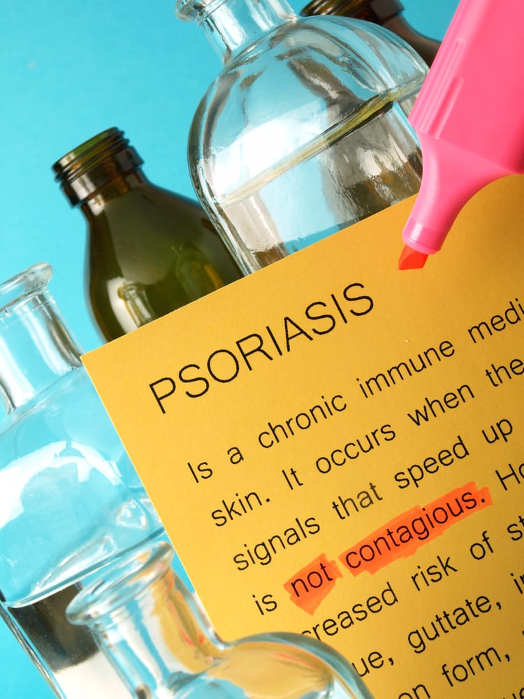 psoriasis