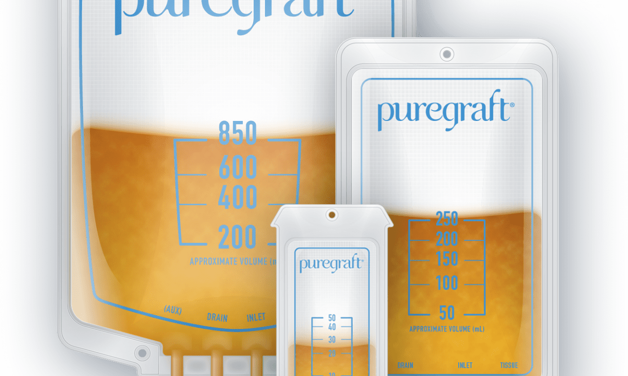 Study: Puregraft Closed System Outperforms Centrifuge for Fat Graft Retention