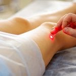 Q-of-L Improvements Following Widely Used Treatments of Varicose Veins