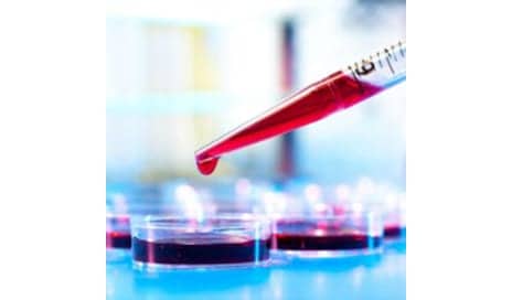Biomarkers Predict How Well You'll Age