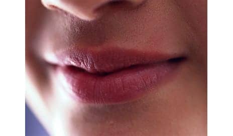 Botox May Help Ease “Burning Mouth Syndrome”
