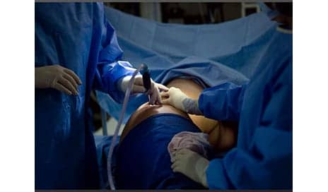 Fake Doctor Sentenced to 38 Years in Prison After Botched Liposuction Surgeries