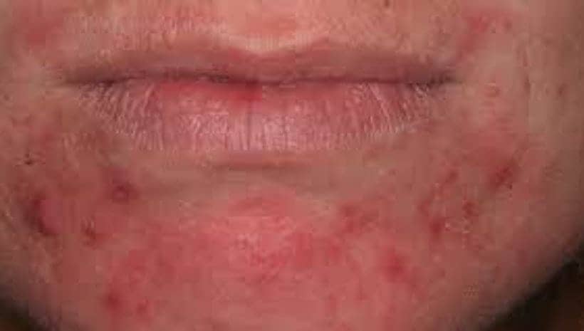 Healthcare Advancements In Cosmetic Surgery