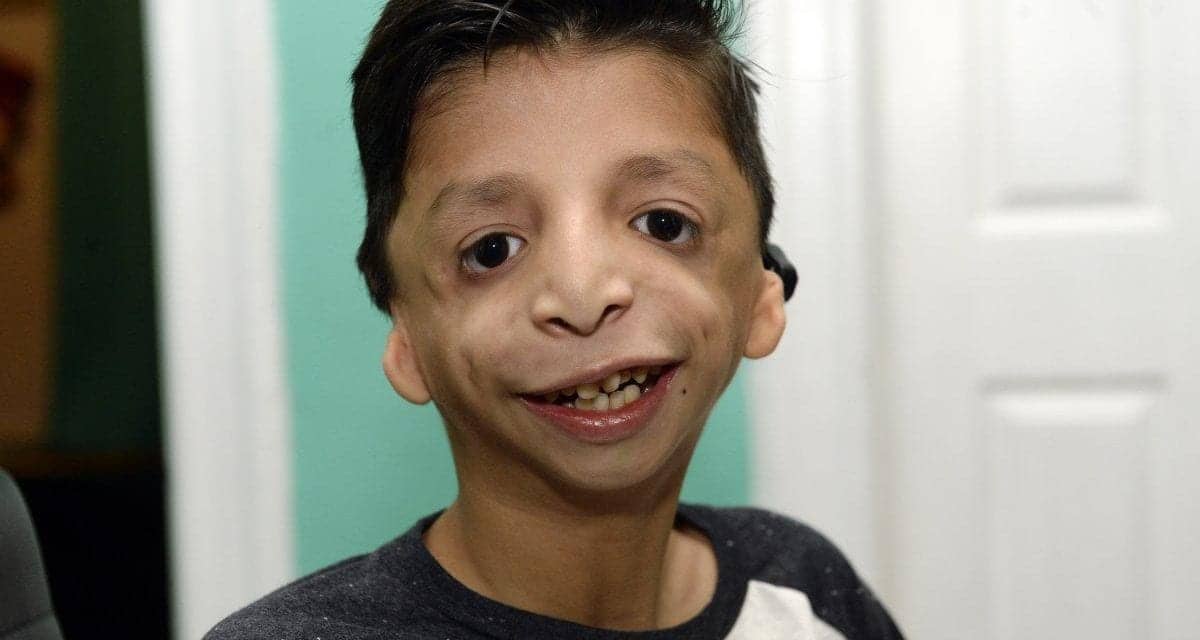 All Boy with Rare Condition Wants for Christmas Is His Two Ears