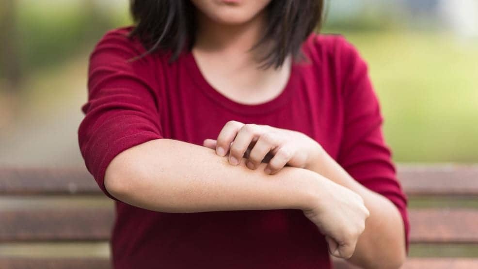 All About Rashes: the Most Common Causes and Treatment Options