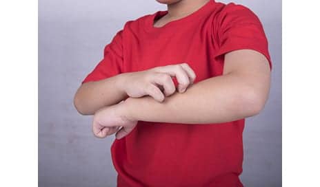 Miller School Dermatologists Identify Genetic Triggers for Chronic Itch