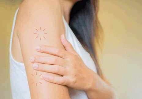 5 Types of Eczema You Should Know, Because There’s Actually More Than One