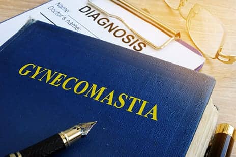 Most Teens with Gynecomastia Don’t Need Hormone Lab Tests