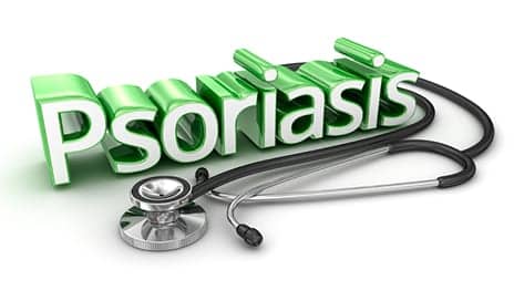 Psoriasis Linked with Greater Need for Cardiovascular Interventions in Patients with Hypertension