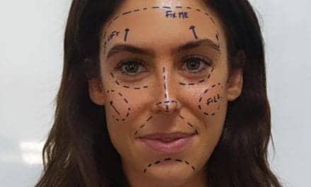 Instagram ‘Fueling Mental Health Crisis’ with “Fix Me” Plastic Surgery Filter