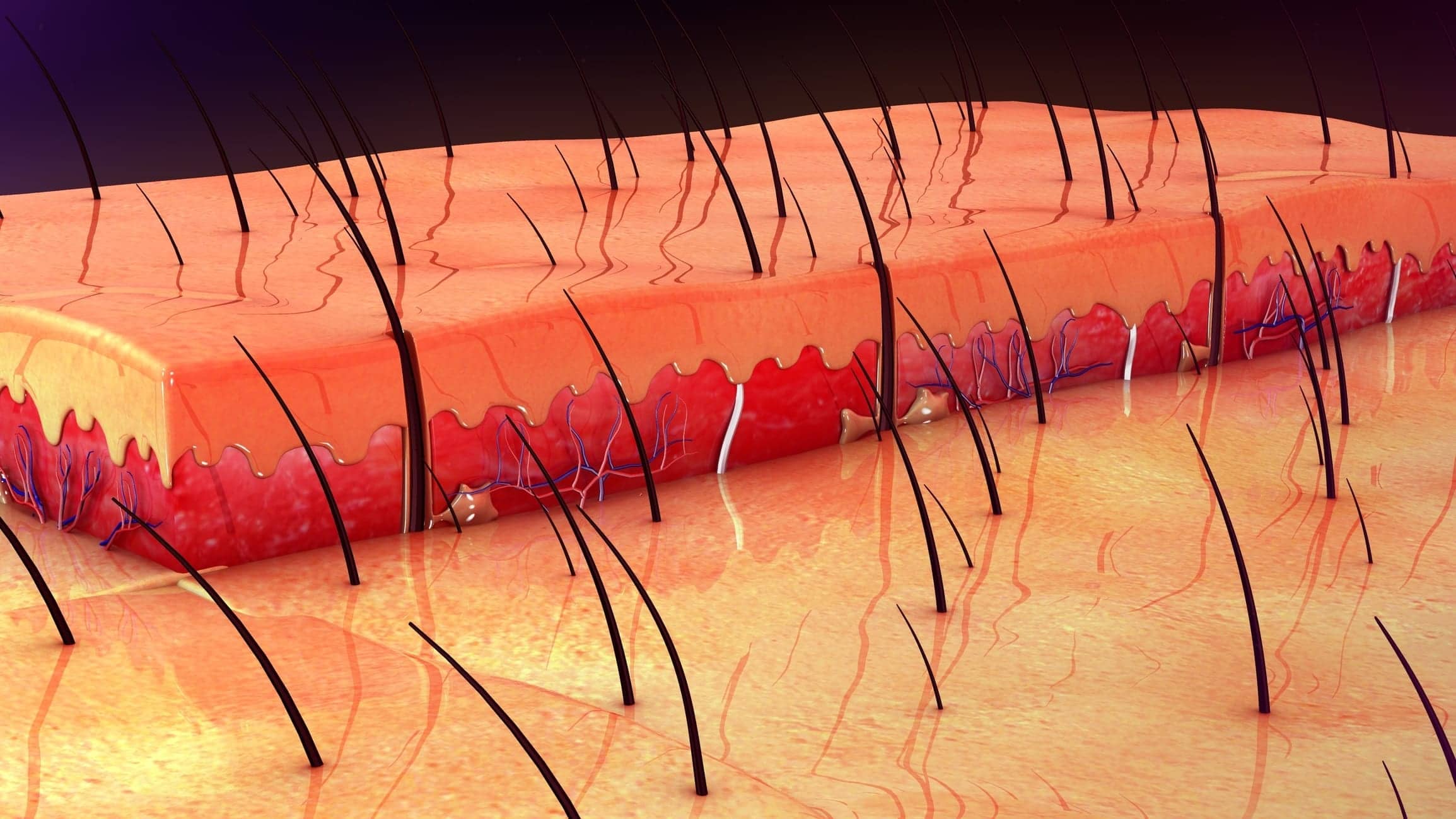 Some Skin Cancers May Start in Hair Follicles, According to Study