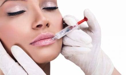 What is a Botox Lip Flip? Experts Weigh In