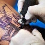 Tattoo Removal Company Seeks to Ride a Wave of Millennial ‘Regretters’