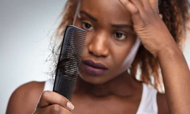 What is Central Centrifugal Cicatricial Alopecia, and Why Does It Primarily Affect Black Women?