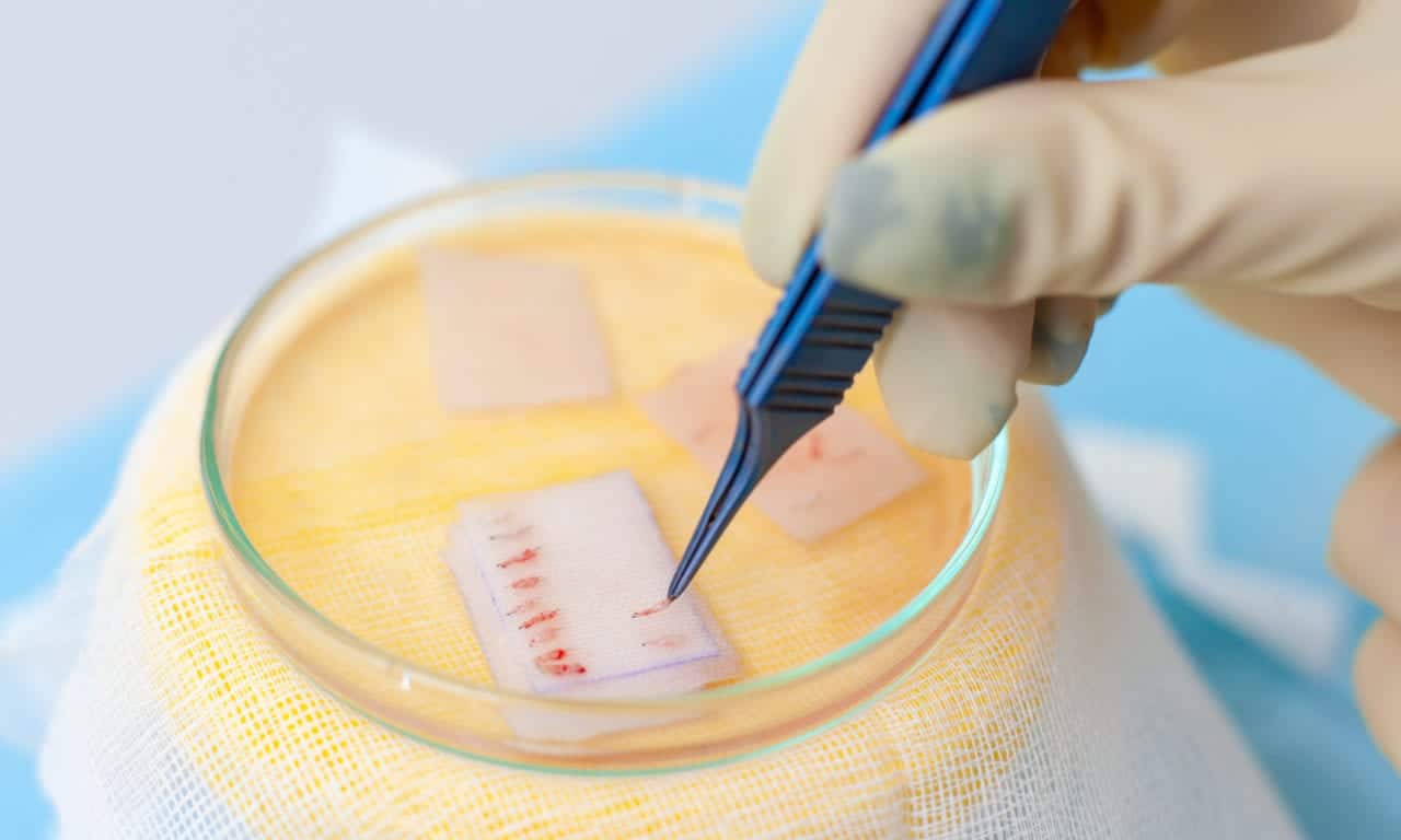 Consumer Interest Grows in Hair Loss Solutions, and the Technologies to Create Better Results