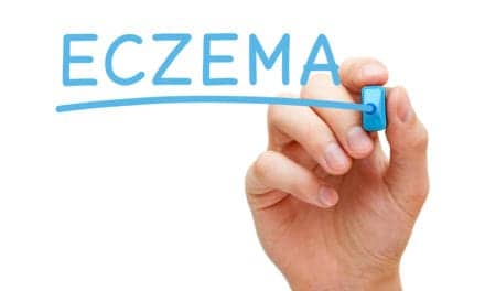 Minimal Link Between Eczema and Most Cancers