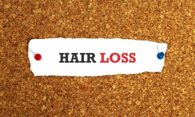 4 Tips to Avoid Hair Loss During a Stressful Holiday Season