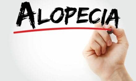 Examining Stigmatizing Attitudes Toward People With Alopecia