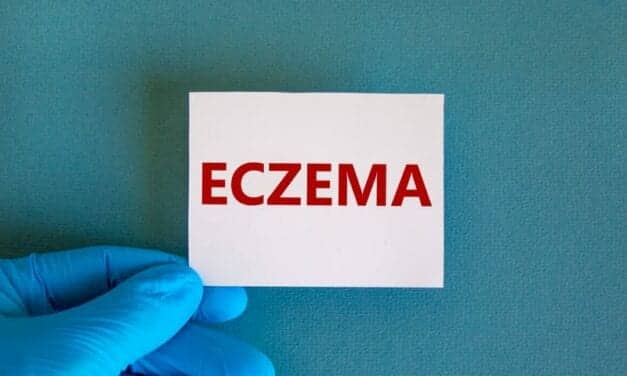 Gene for Sex Hormone Synthesis Could Play Key Role in Eczema