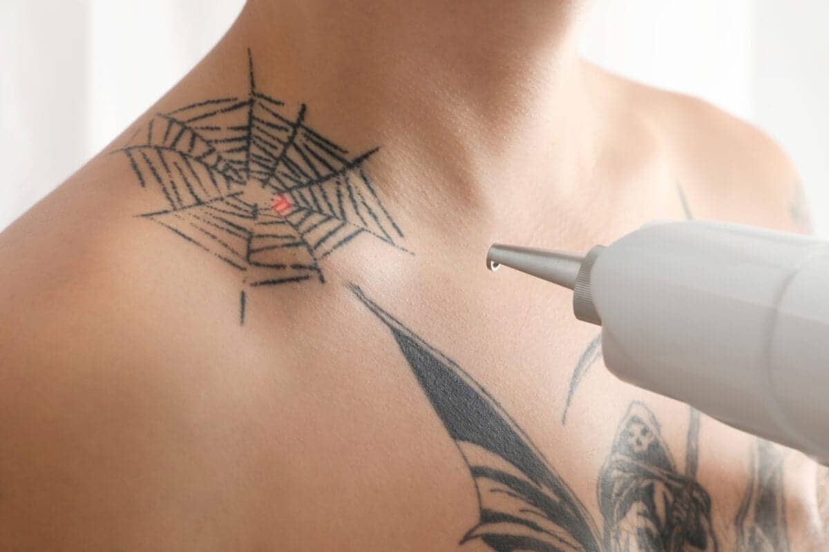Fresh Start Tattoo Removal Program inspire ideas 2022