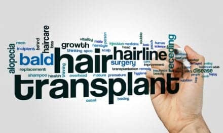 Losing Strands? Get Natural-Looking Results With Hair Transplant Surgery