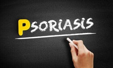 Adult Cancer Survivors Have Higher Risk for Comorbid Psoriasis