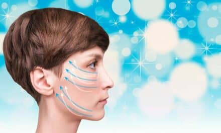 The Psychological Impact of a Facelift