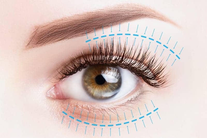 Everything You Need To Know About An Upper Eyelid Lift