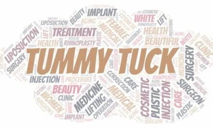 What to Know About an Extended Tummy Tuck