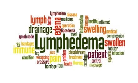 What You Need to Know About Lymphedema