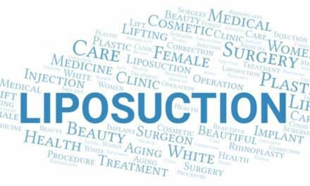 What is Tumescent Liposuction?