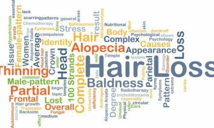 Low-Level Laser Therapy for Hereditary Hair Loss