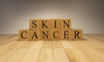 Researchers Reveal How Skin Cells Form a First Line of Defense Against Cancer