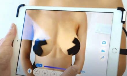 New Software Helps Patients Preview Their Post-Surgery Appearance