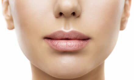 5 Signs of a Stellar Lip Lift, According to Facial Plastic Surgeons