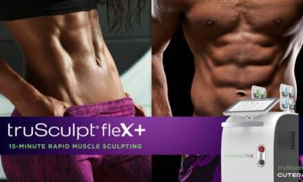 Cutera Launches Next Gen Rapid Muscle Sculpting with truSculpt flex+