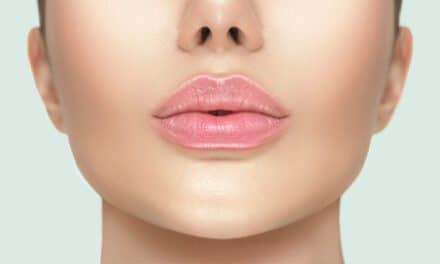 Influencing the Industry: Hollywood Plastic Surgeons Meet Demand for New, Improved Lip Lift￼