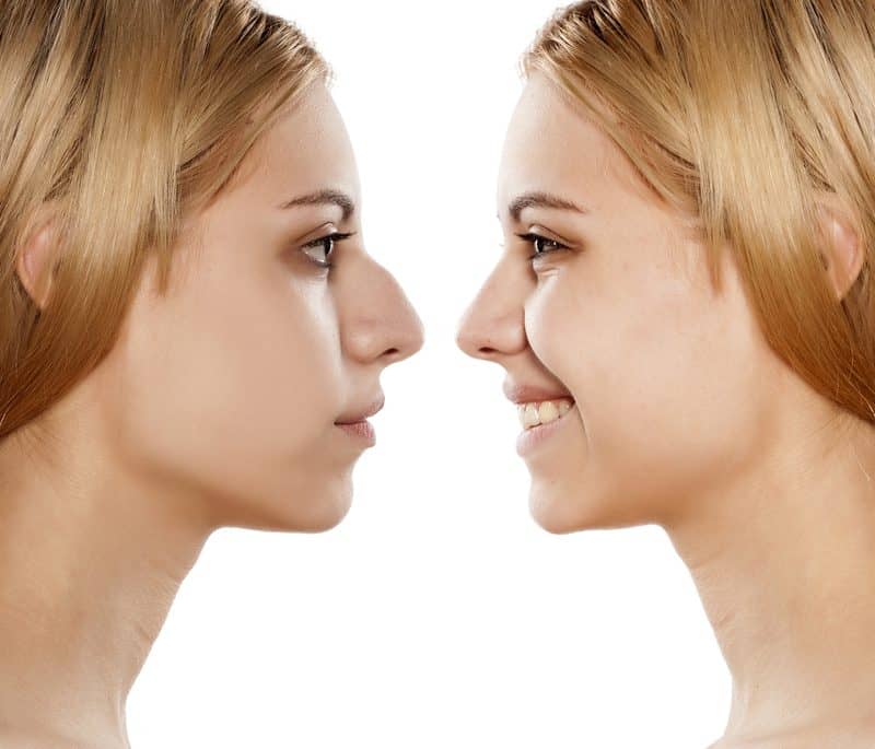 Influencing the Industry: Nose Jobs and Veneers—Workers Spend Big to Look Good for Return to Office