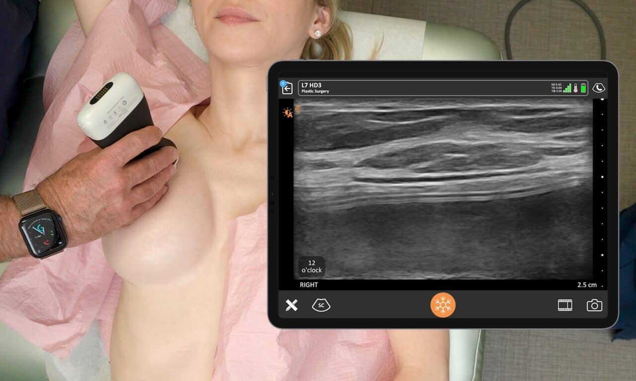 Ultrasound in Plastic Surgery: Going Beyond Skin Deep