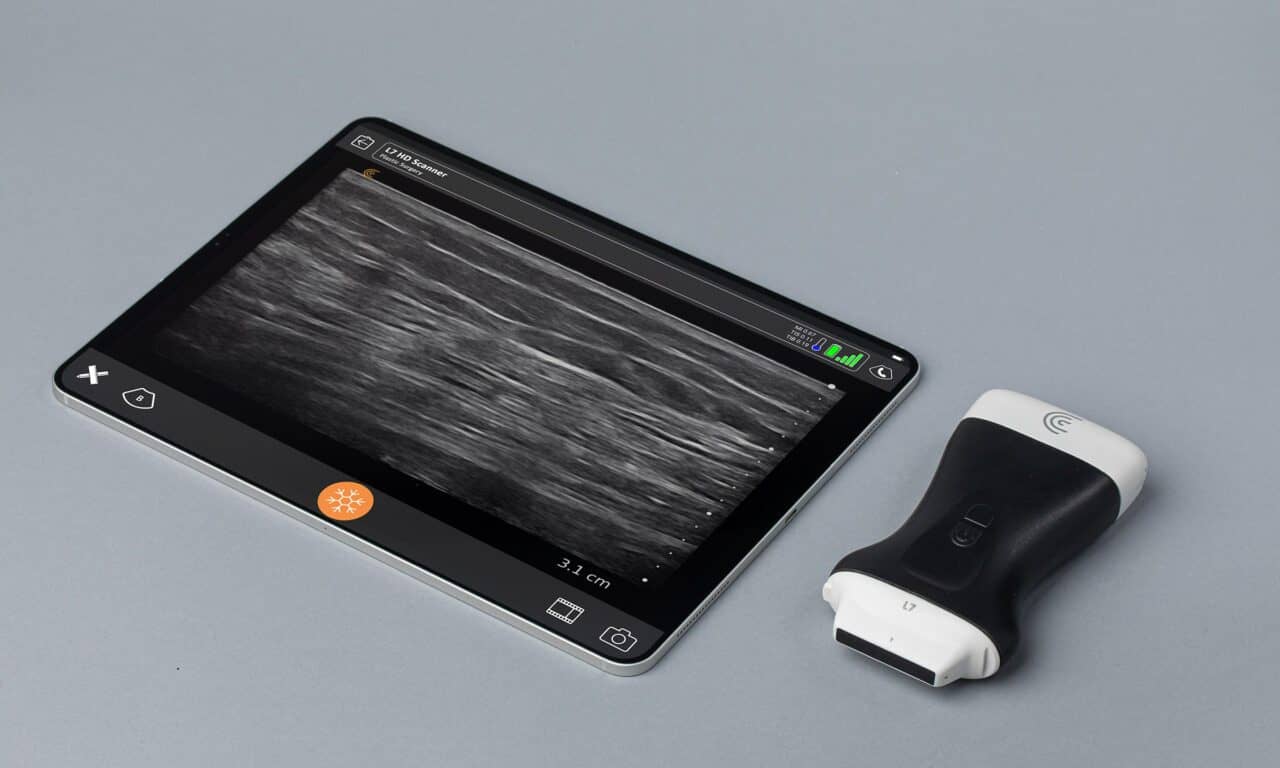 Florida Plastic Surgeons Deploy Clarius Ultrasound Amid BBL Order