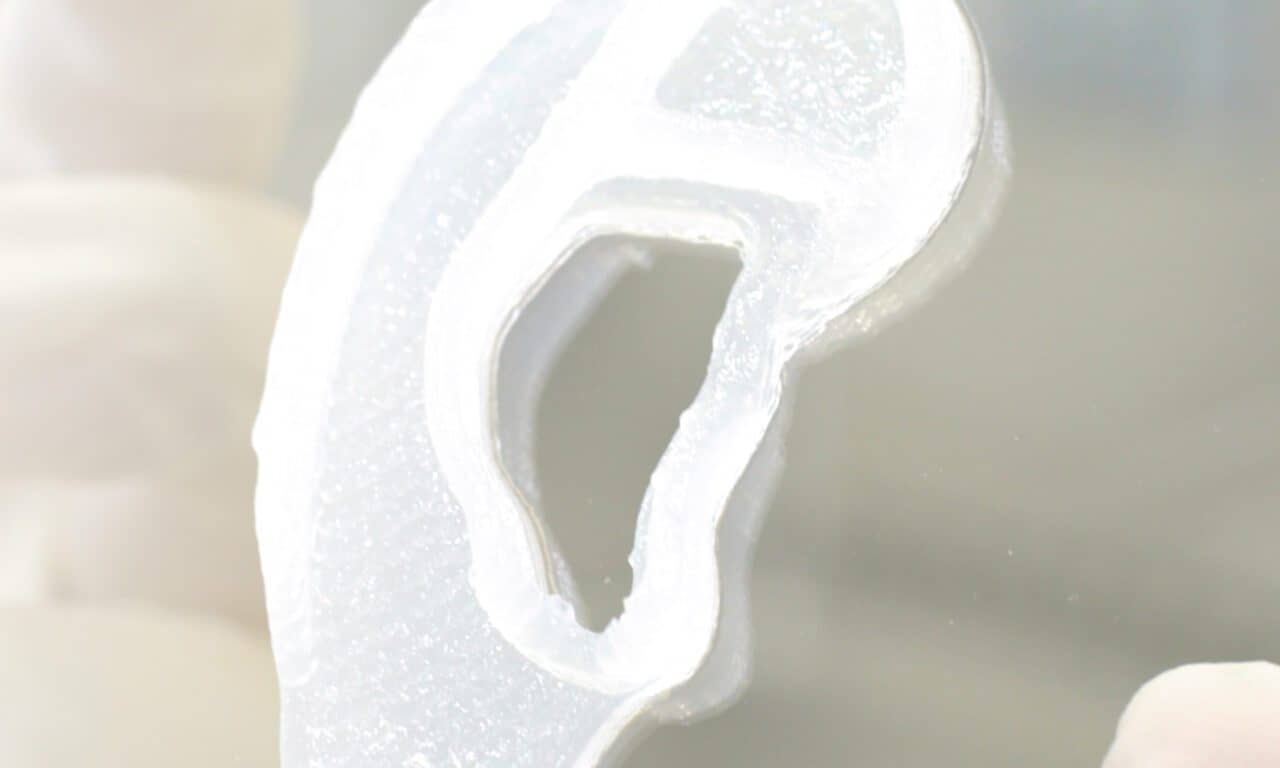 Researchers Conduct Human Ear Reconstruction Using 3D-Bioprinted Living Tissue Implant