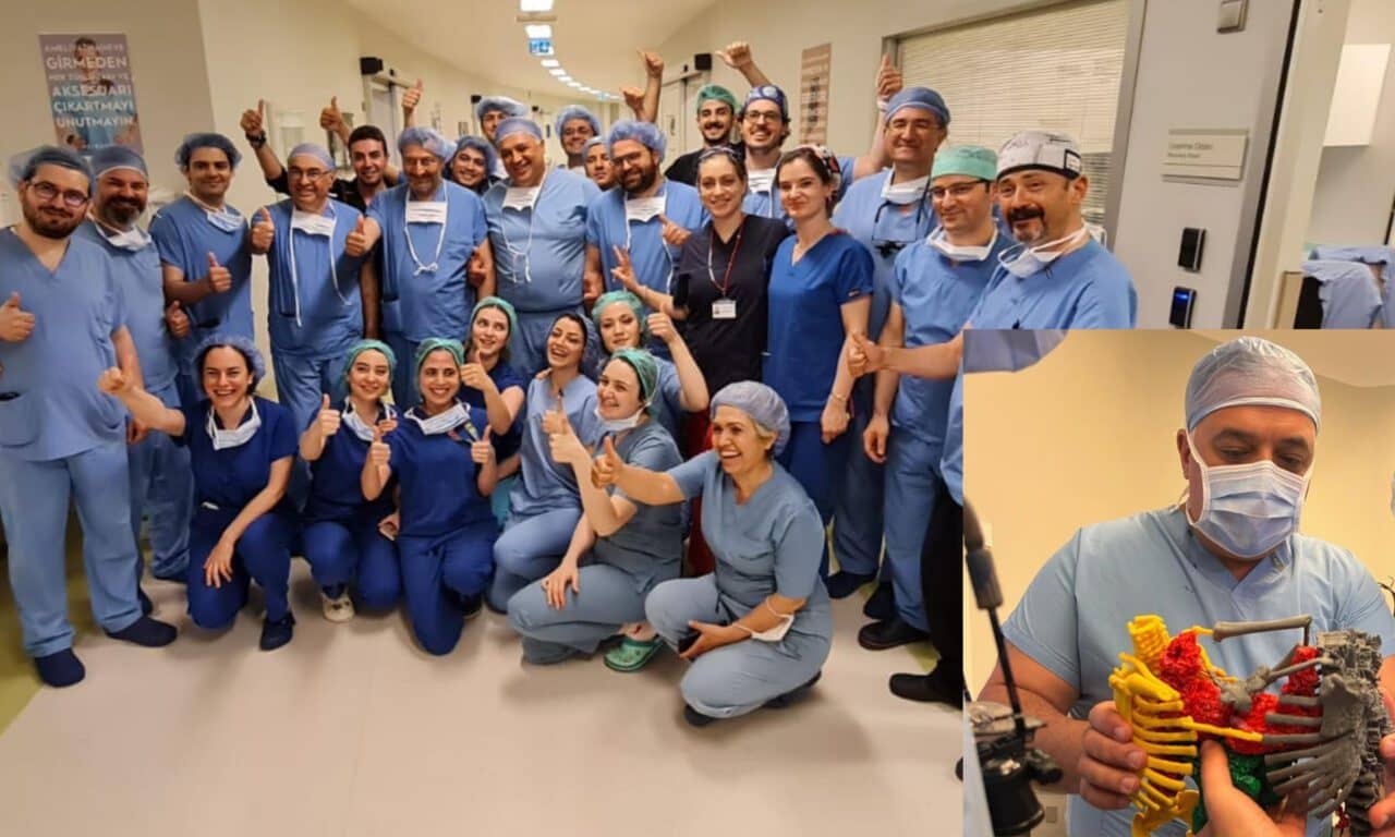 Turkish Medical Team Separates Conjoined Twins in Nine Hours, Breaking World Record