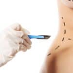 Demand for Cosmetic Surgery, Driven by Women Under 45, Surged After the Pandemic 