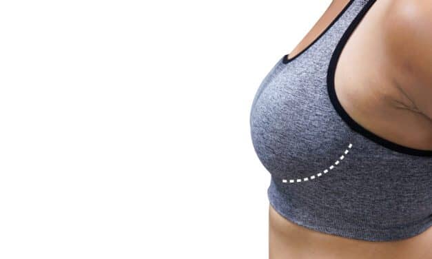 Regenative Labs Highlights Advancements in Post-Surgical Breast Reduction 