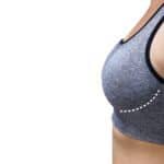 Sientra Launches Viality Fat Transfer System 