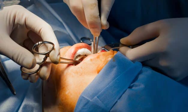 Inside the Buccal Fat Removal Surge