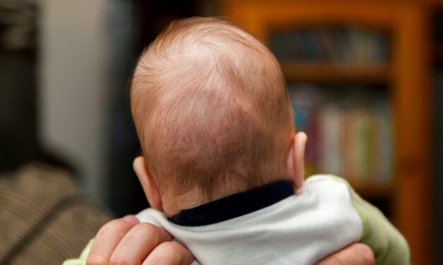 Factors Linked to Cognitive Impact of Delayed Craniosynostosis Surgery