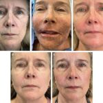 Plastic Surgeon Develops Novel Anti-Aging Treatment