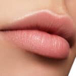 Pucker Up: The Growing Popularity of Lip Flips
